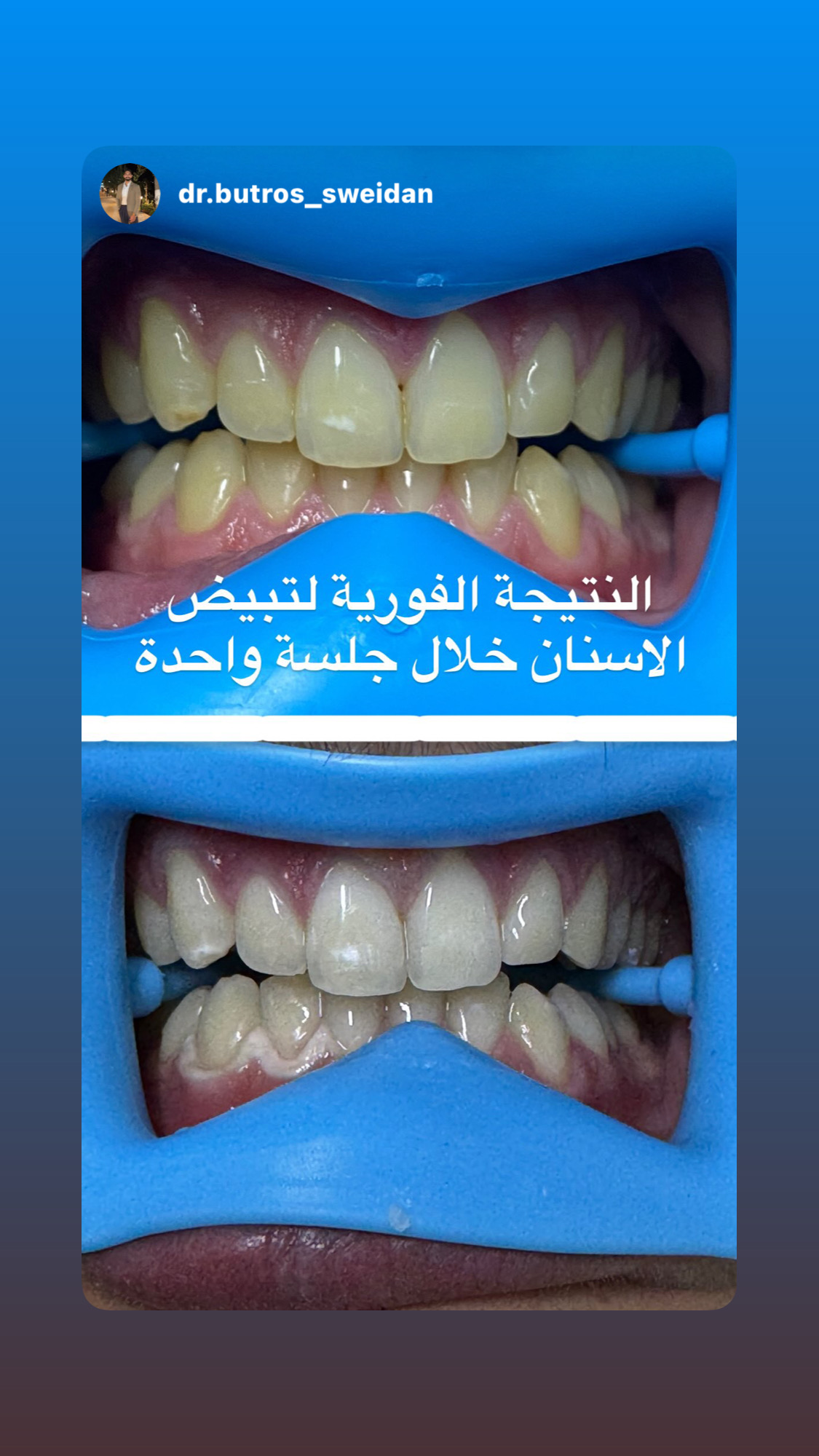 تجميل الأسنان