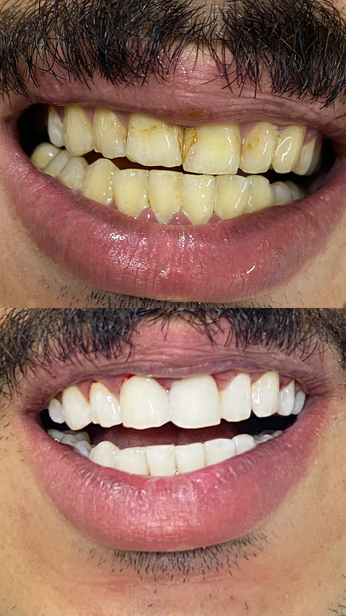 تجميل الأسنان