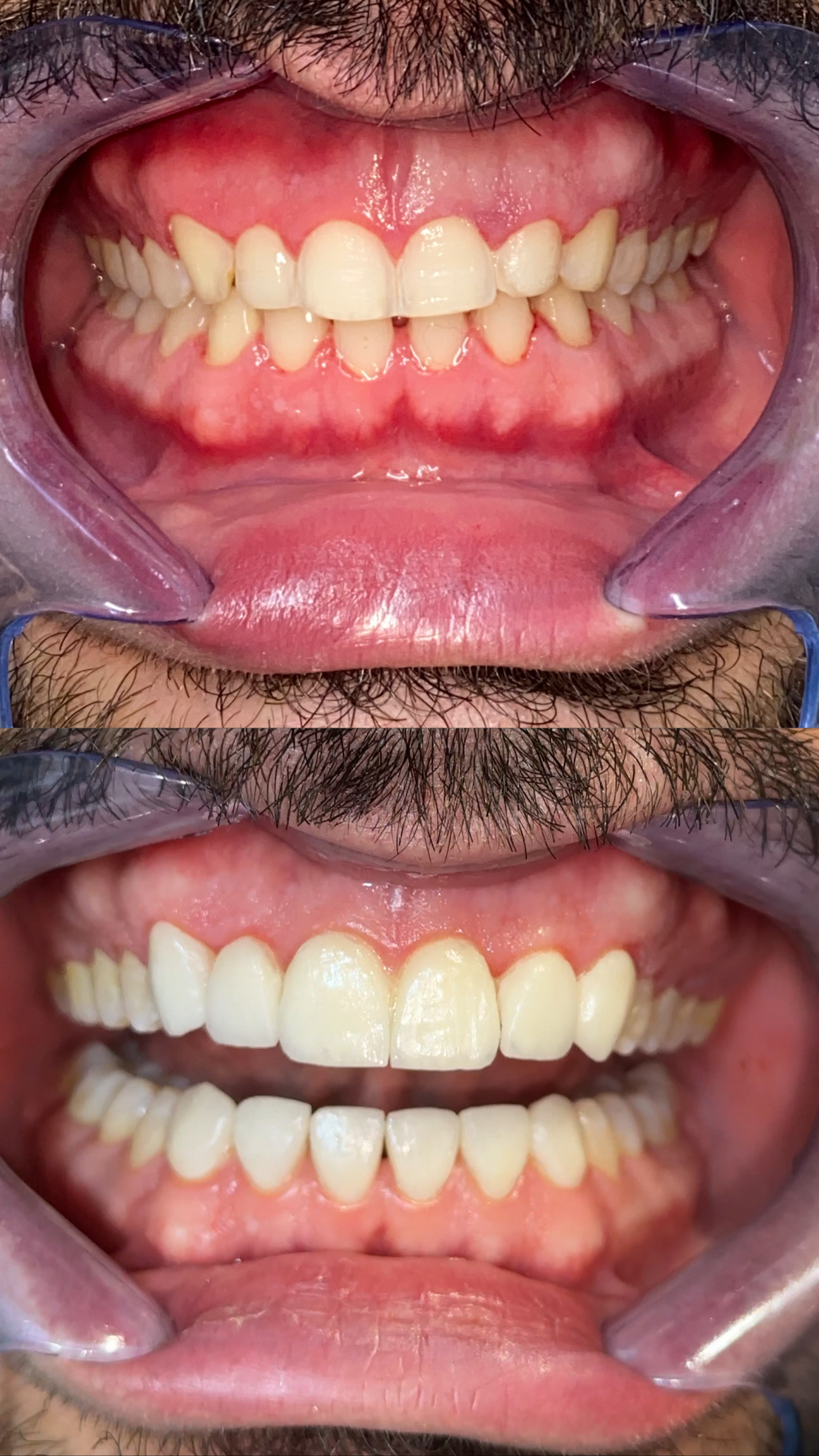 تجميل الأسنان